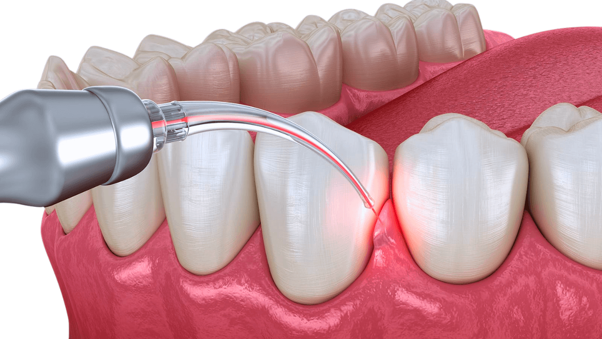 Digital Dentistry & Advance Dental Implantology