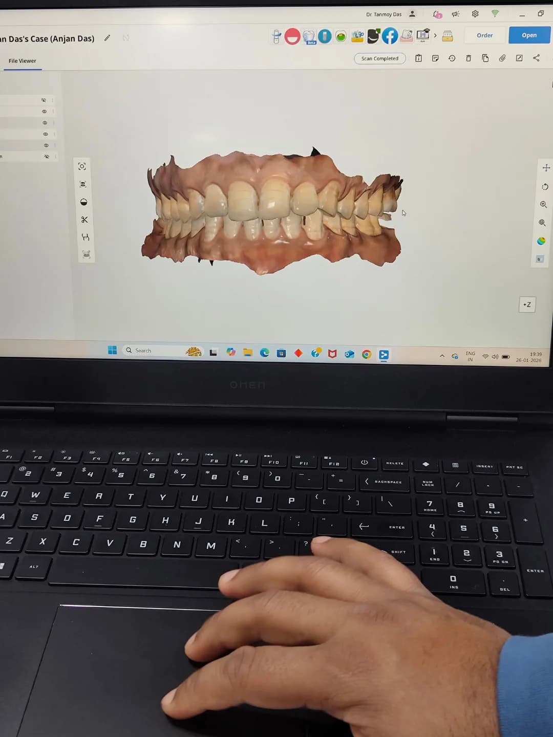 Dental Instrument 18